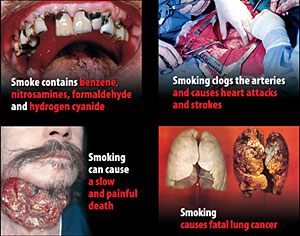 Imágenes que verán los británicos en todas las cajetillas de tabaco